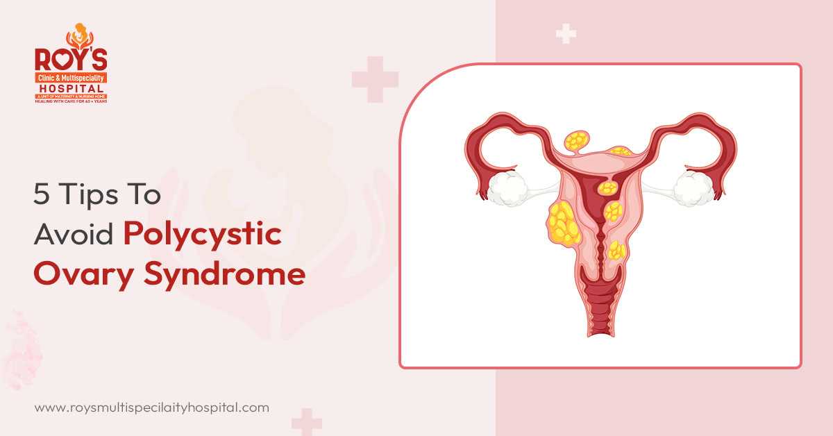 Polycystic Ovary Syndrome